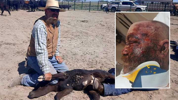 Burned To Bone In Welding Explosion, Jeffrey City Father Of 5 Faces A New Reality