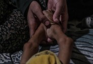 Los muertos por desnutrición en Gaza superan ya los 250, incluidos 11 este viernes