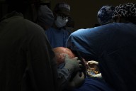 Especialistas de IMSS Querétaro retiran tumor ovárico de 22 kilos en paciente 