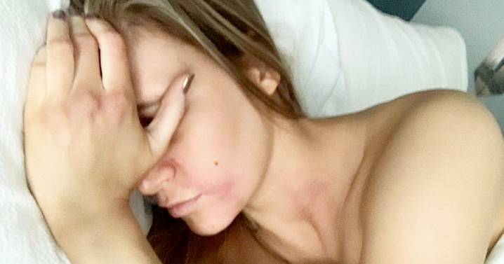 Mum with Lyme disease like Justin Timberlake says 'it's terrible to live with'