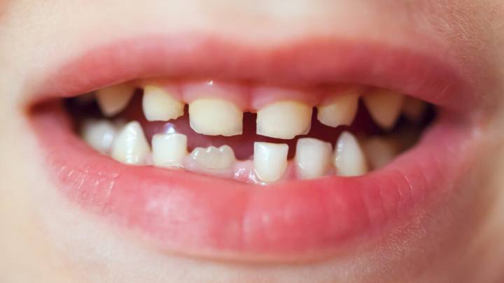America has an oral health crisis