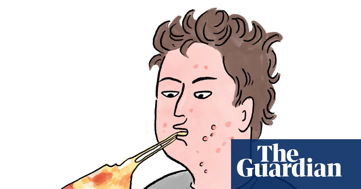 Is it true that … eating greasy food causes spots?