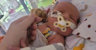 'My baby was born with a fatal illness but a tiny umbrella saved his life'