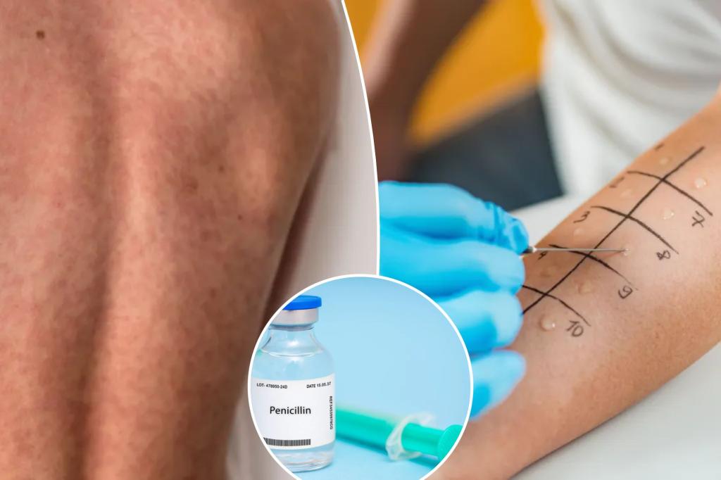 Many Americans think they have this allergy