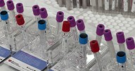 Minnesota dealing with low blood supply; health officials call for donations