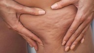 La rutina de ejercicios que podés hacer al aire libre o en tu terraza y que ayuda a eliminar la celulitis en las piernas