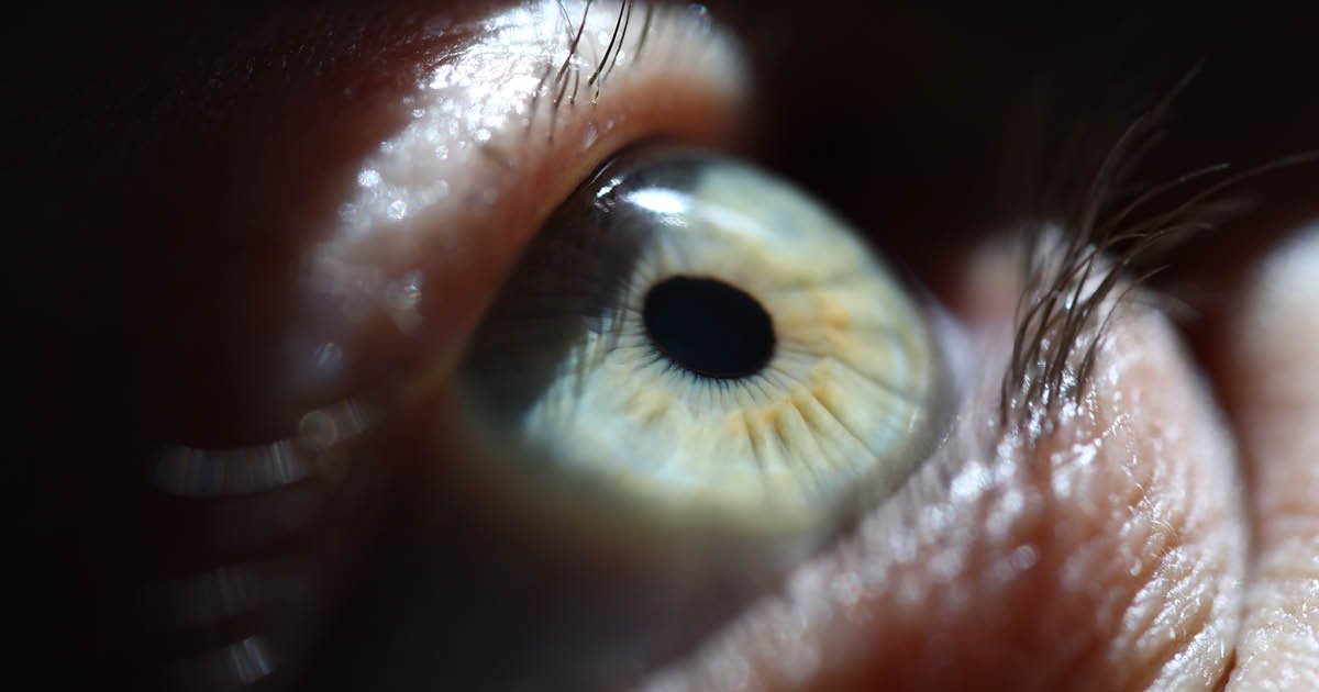 Neuropathic corneal pain reduced in phase 2 trial of urcosimod