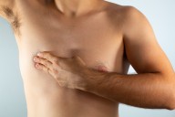 Cáncer de mama en hombres: tener unos kilitos de más, podría ponerlo en riesgo