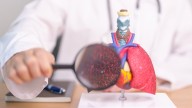 FDA Approves New Option for NCFB