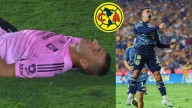 Liga MX: América goleó a Tigres, con "OSO" incluido de Nahuel Guzmán