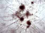 Concurso de Fotografía Microbiológica 2025: conocé a los ganadores