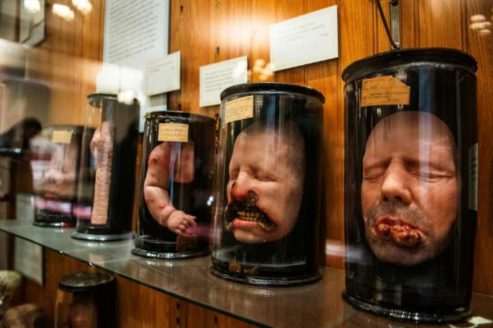 Esqueletos anónimos: un museo en el centro de un debate ético