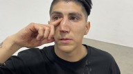 Chivas: Hermano de Ángel Zaldívar sufre fractura de nariz en las gradas del Estadio Akron