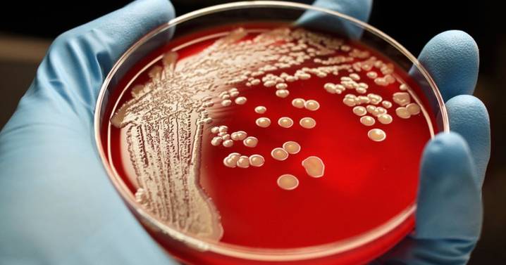 AI-designed antibiotics could kill drug-resistant superbugs such as gonorrhoea and MRSA