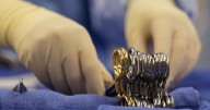 What to know about organ donation