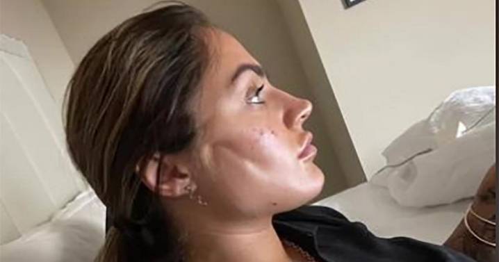 Worst botched beauty jobs from gargoyle face to coma as UK takes on Cosmetic Cowboys