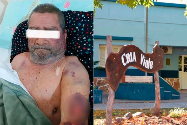 Jubilado golpeado en Viale: una mujer le provocó lesiones tras una discusión