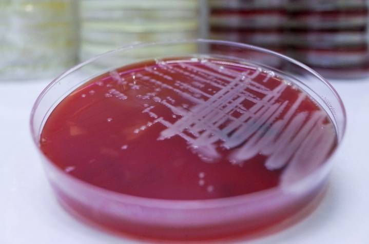 2 dead, 58 sick amid legionnaire's disease outbreak in Harlem