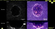 Captan por primera vez en 3D la implantación de un embrión humano en tiempo real