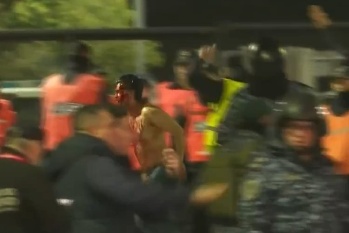 Hincha de la U completamente ensangrentado logró arrancar de un destino peor en Avellaneda