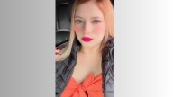 ¿Qué causó la muerte de joven durante cirugía estética en Monterrey? Esto dice la autopsia