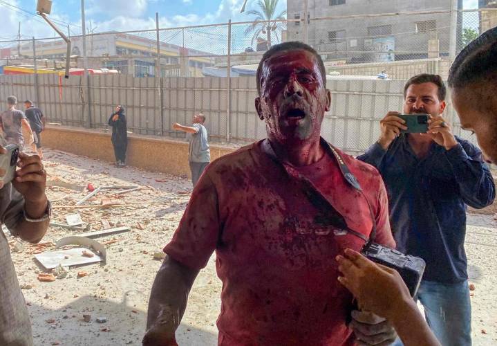 Un doble ataque contra el principal hospital del sur de Gaza causa 19 muertos, entre ellos 4 periodistas
