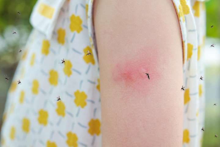 Virus del Nilo Occidental confirmado en un residente de Louisville