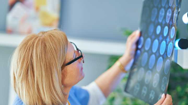 El compuesto que podría ser clave en la lucha contra el cáncer, según una doctora: “Disminuye las recaídas y mejora la supervivencia”