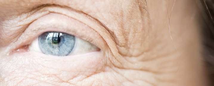 Scientists Finally Explain Why Your Skin Wrinkles As You Age