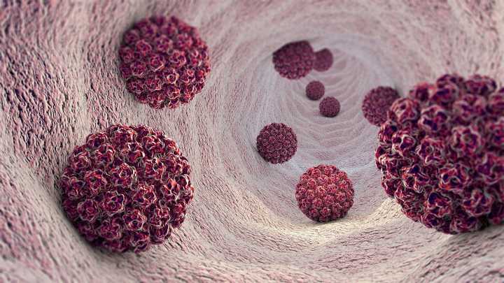 Most Americans Unaware HPV Causes Oral Cancers