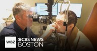 Canadian man regains eyesight after surgery uses his own tooth to restore vision
