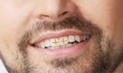 Rylan's new dental treatment