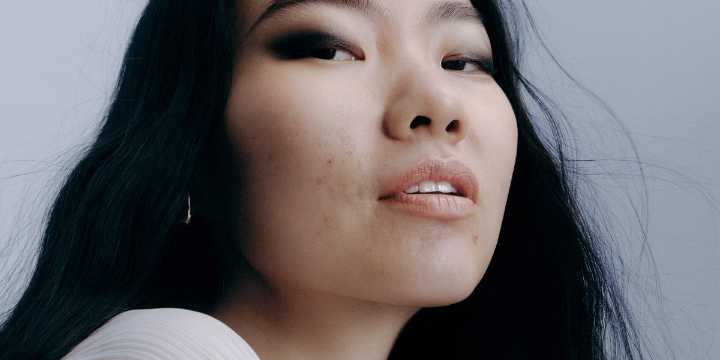 Best Skincare Routine for Acne 2025, According to Dermatologists