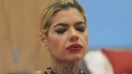 Un perro atacó el rostro de Melissa Gate: el momento quedó registrado en video