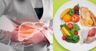 Comer para vivir: Grasas permitidas en hígado graso leve a moderado