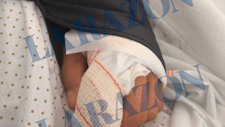 Un drogadicto amputa de un mordisco un dedo a un guardia civil
