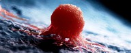 'Universal' Cancer Vaccine Destroys Resistant Tumors in Mice