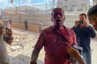 Mueren cuatro periodistas, entre ellos uno de Reuters y otro de Al Jazeera, tras un ataque israelí al hospital Nasser en Gaza
