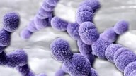 Deaths from flesh-eating bacteria are on the rise. Who is at risk?
