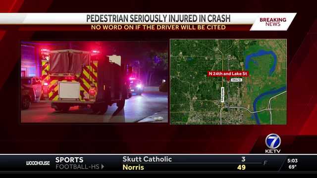 Pedestrian seriously injured after being hit by car