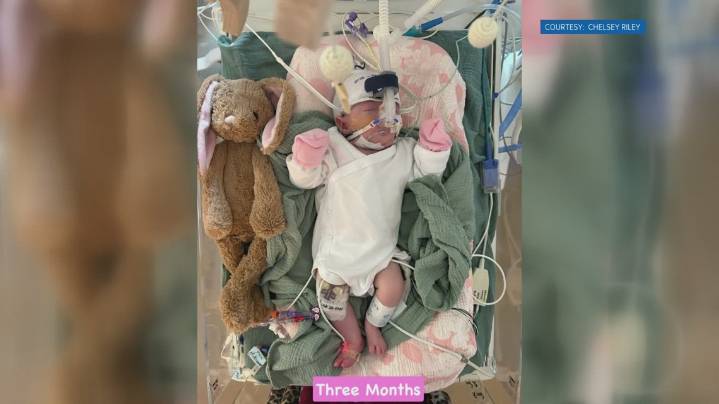 Knoxville baby born with Trisomy 18 defies odds
