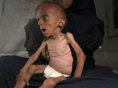 Gaza registra diez muertos por desnutrición el viernes, tres de ellos menores