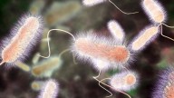 Harlem legionnaires’ disease outbreak up to 90 cases, 15 hospitalized