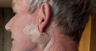 Skin cancer warning signs as Gordon Ramsay issues message after diagnosis