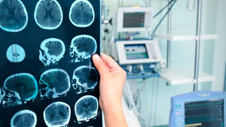 Científicos revelan las mejores 6 técnicas para fortalecer la memoria