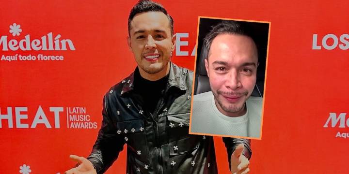Alexis Escobar confesó que puso en riesgo su salud por cuenta de tratamiento estético: “Me salió caro el chiste”