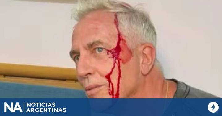 Marley se accidentó en Tailandia: "Quedé chorreando sangre"