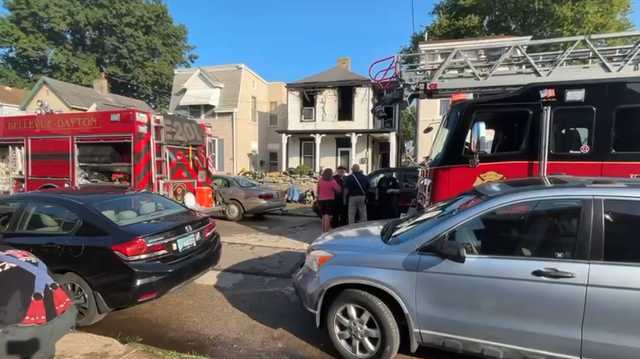 FD: 3 children hospitalized, 1 seriously burned in Northern Kentucky house fire