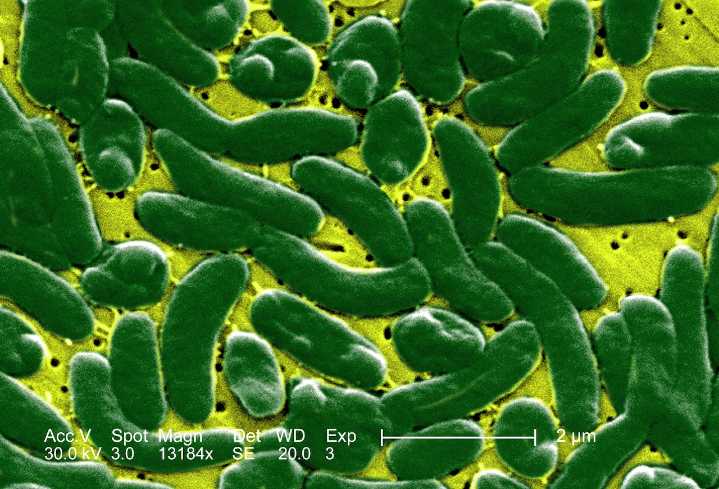 Flesh-eating bacteria infections on the rise this summer in several states