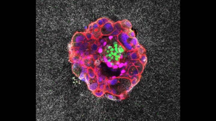 In a First, Scientists Capture Human Embryo Implantation in Real Time
